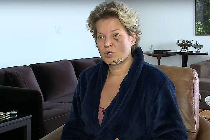 Câmeras não mostram ninguém suspeito em apartamento de Joice Hasselmann, diz Polícia Legislativa