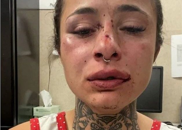 Tatuadora brasileira é agredida pelo namorado nos EUA e pede ajuda