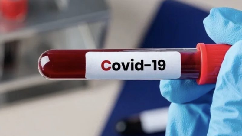 AL tem o menor número diário de novos casos de covid-19 desde abril de 2020