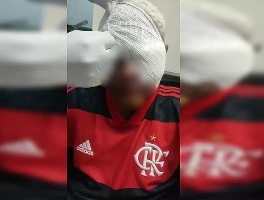 Jovem autista perde olho após ser espancado em jogo de futebol