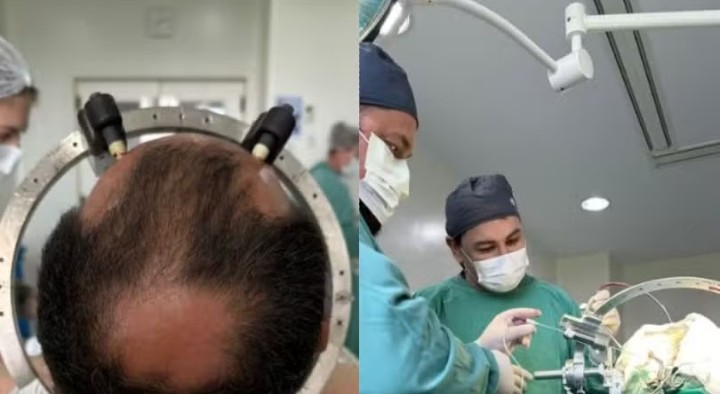 Microchip cerebral para tratamento de TOC é inserido pela 1ª vez em SC: ‘Avanço importante’, diz médico