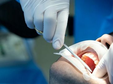 Descubra as principais causas de perda de dentes na população adulta